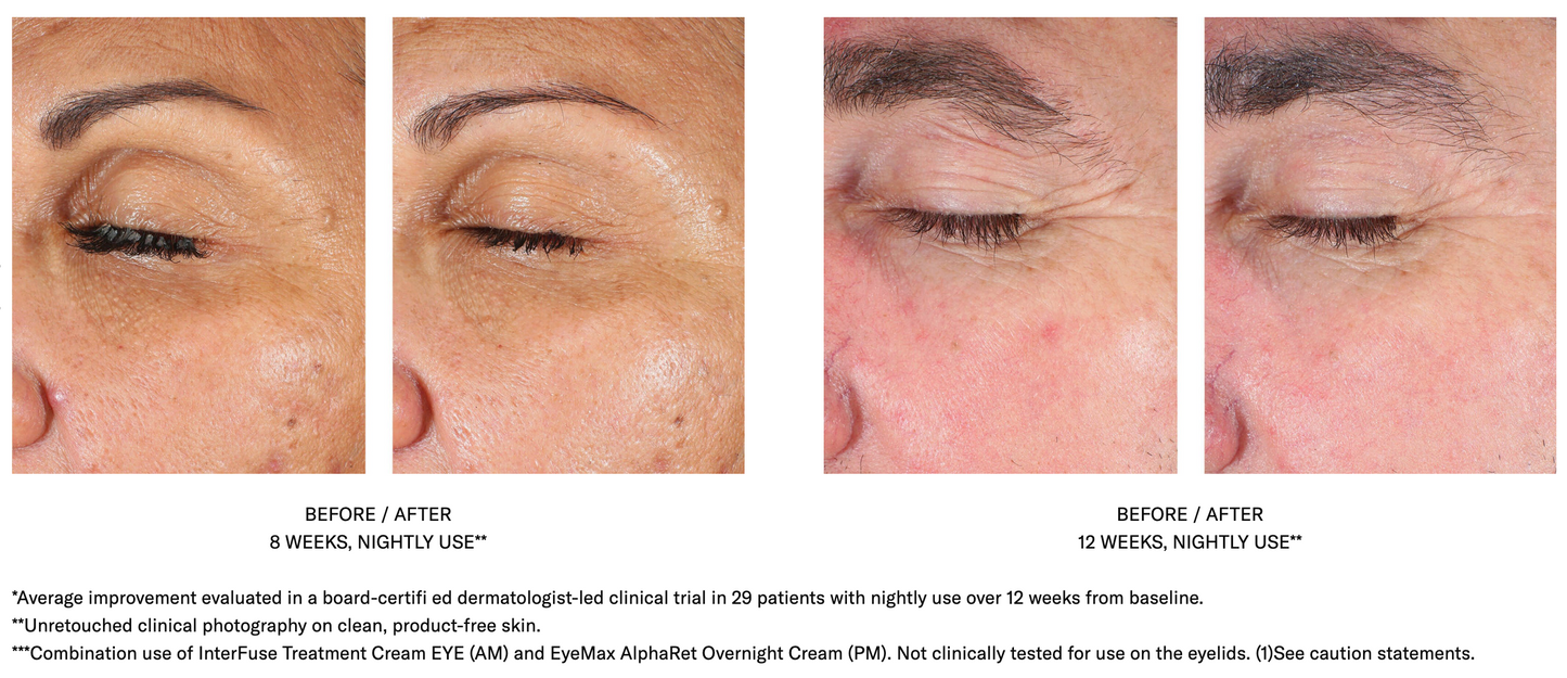 EyeMax AlphaRet Overnight Cream