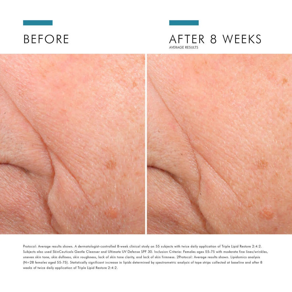 Triple Lipid Restore 2:4:2