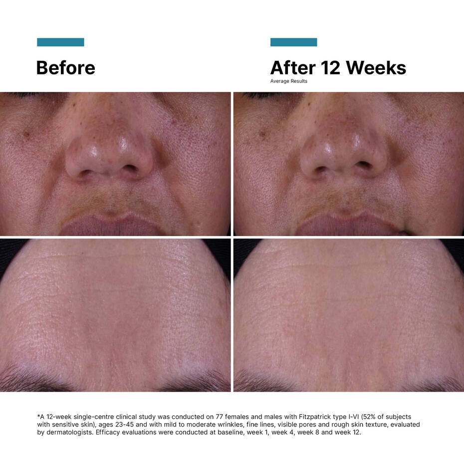 P-TIOX Anti-Wrinkle Cream