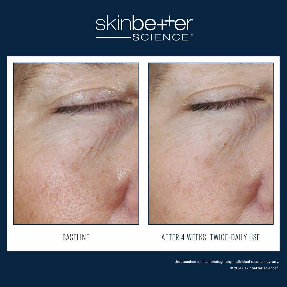 Instant Effect Gel EYE