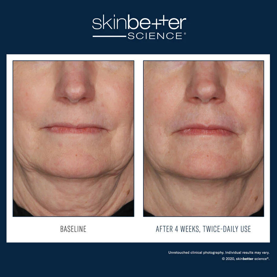 InterFuse Treatment Cream FACE & NECK
